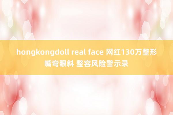 hongkongdoll real face 网红130万整形嘴弯眼斜 整容风险警示录